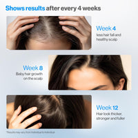 Advanced Hair Growth Serum™